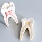 Der Zusammenhang zwischen Zahnerkrankungen und chronischen Erkrankungen